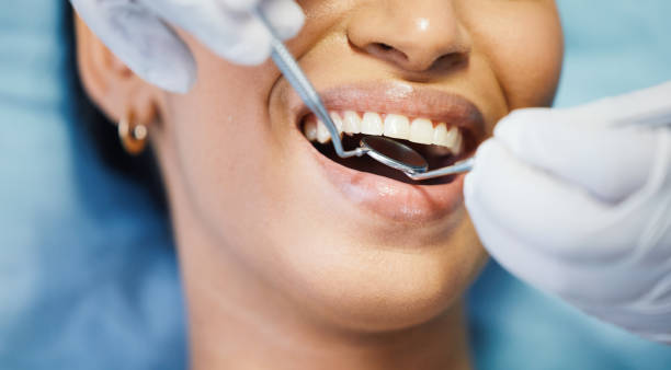 Best Emergency Dental Care for Broken or Chipped Teeth in Yoakum, TX